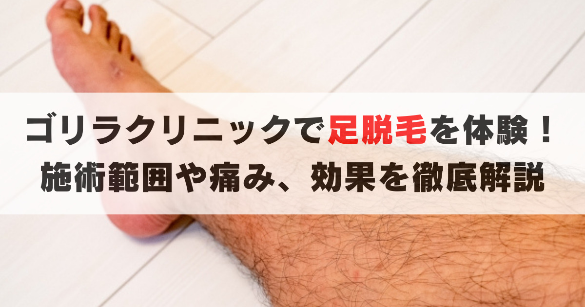 ゴリラクリニックで足脱毛(すね, もも, 足)を体験！痛みや効果を解説します