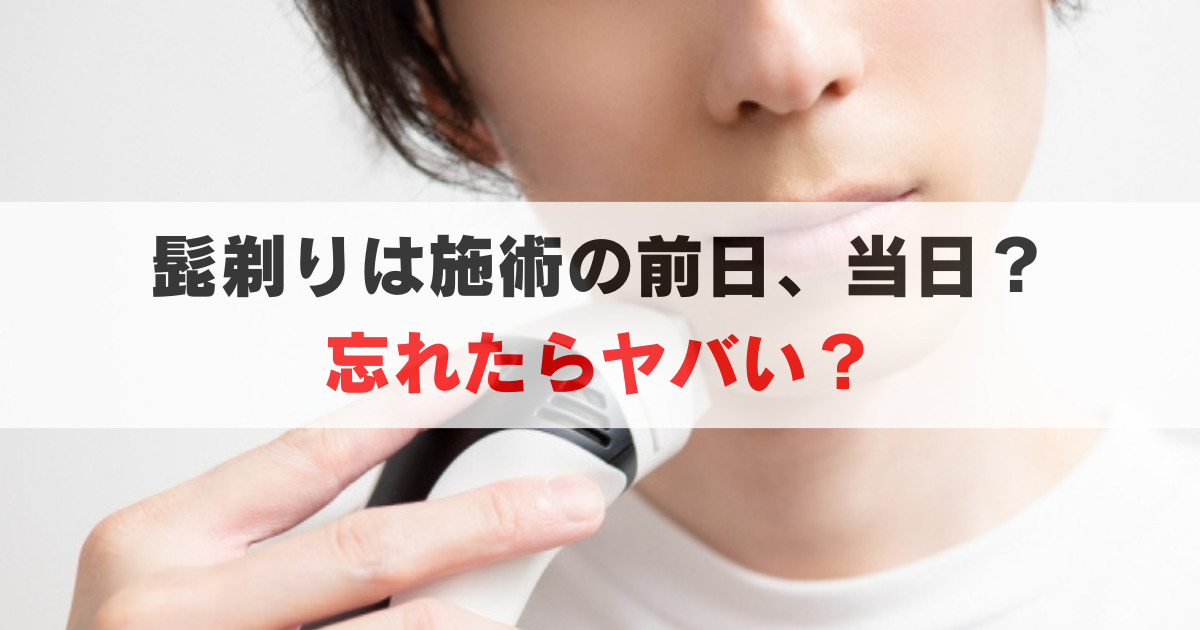 ゴリラクリニックの施術前, いつ髭を剃るべき？忘れた時は施術不可？