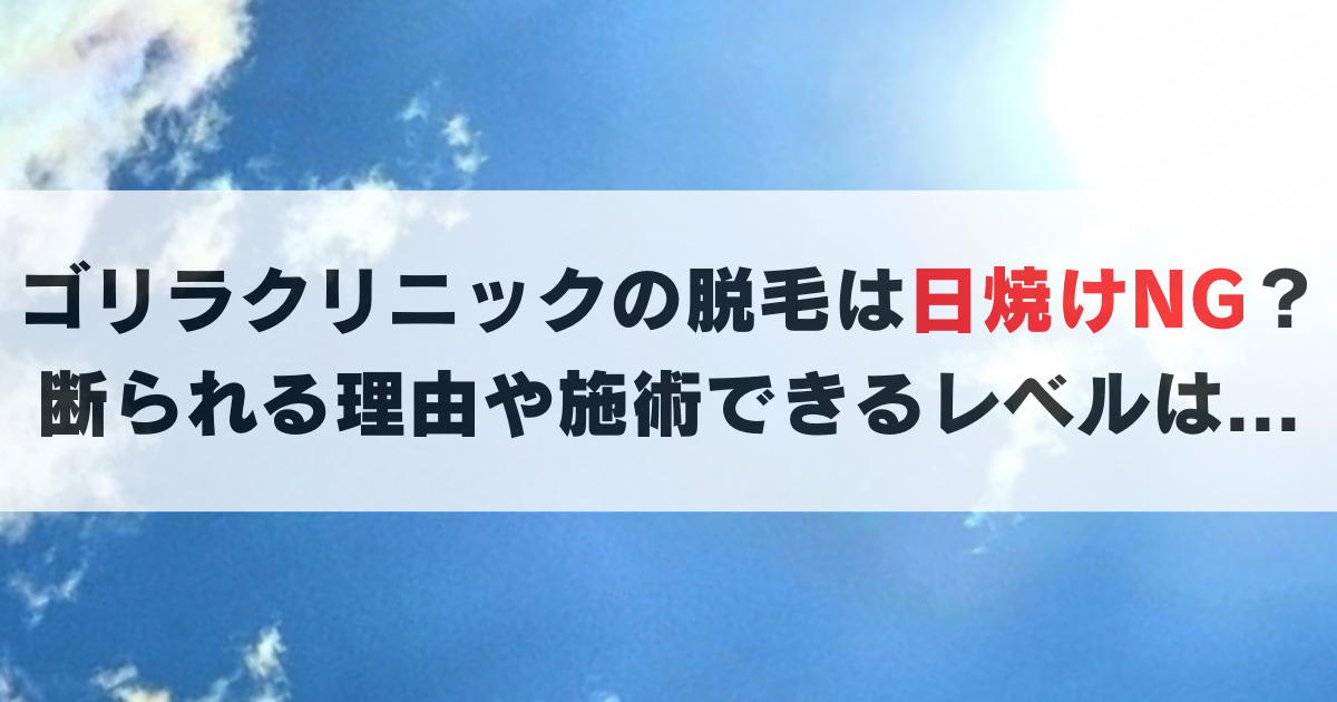 ゴリラクリニック｜日焼けで断られるレベルと理由。日焼け後に施術した感想も