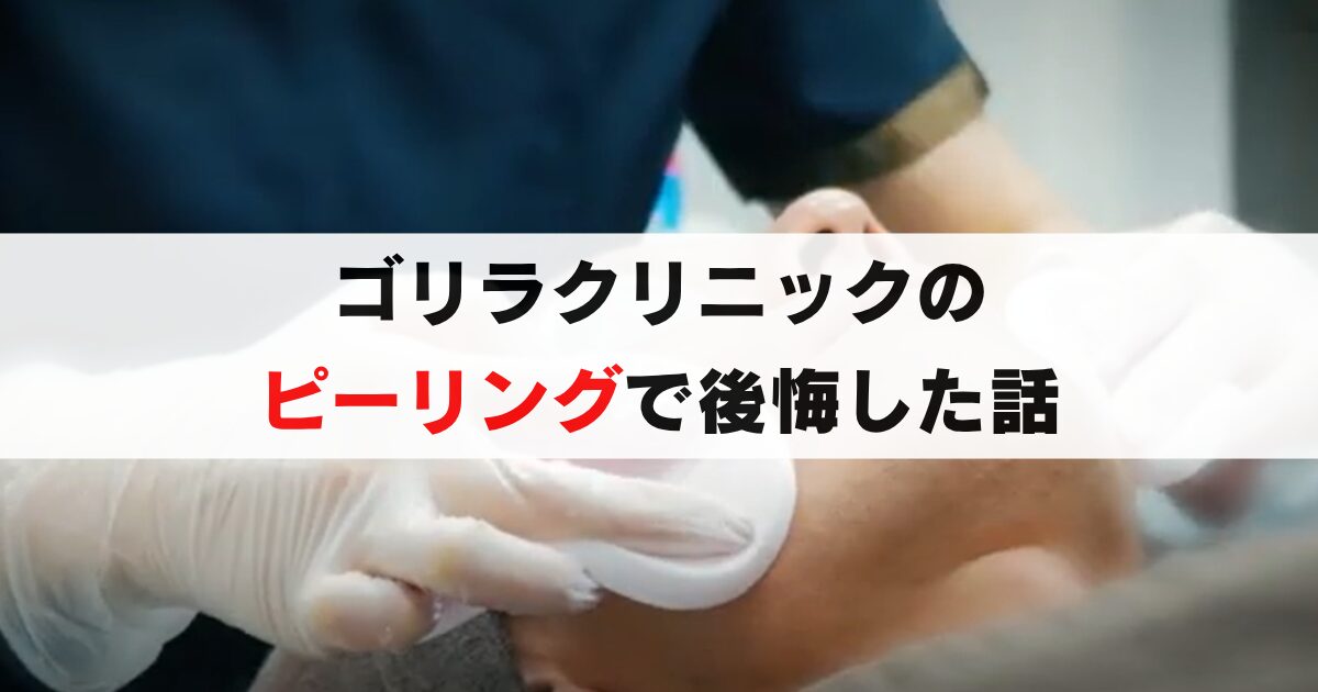 【後悔した】ゴリラクリニックのピーリングはいらないと思った体験談